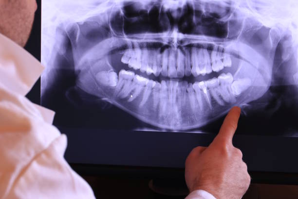 Best Emergency Dental Care for Broken or Chipped Teeth in Web, AL